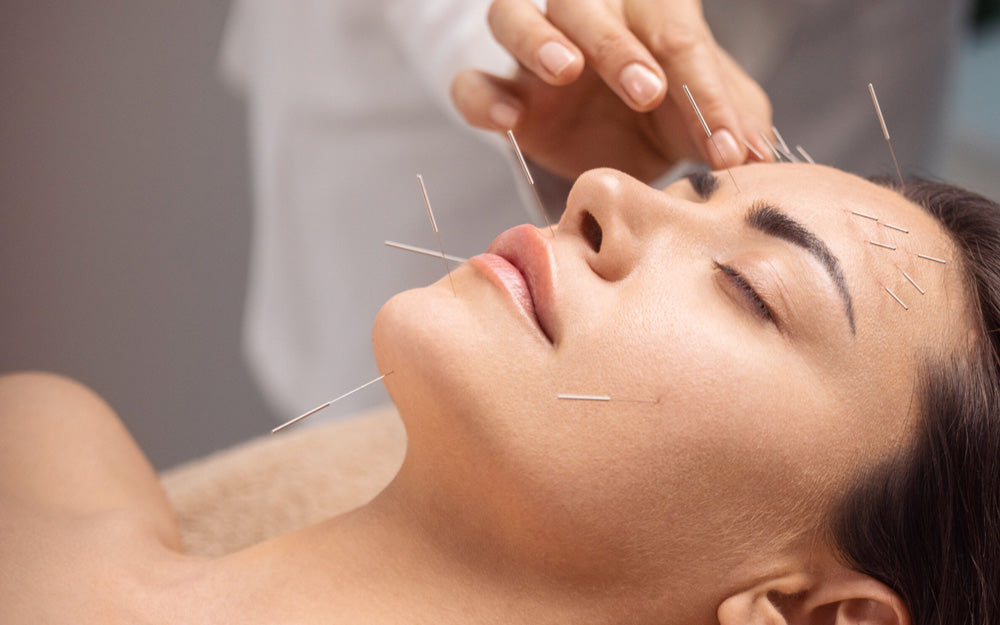 Woman receiving facial acupuncture therapy