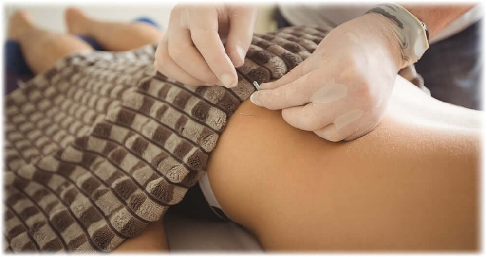 Woman receiving facial acupuncture therapy, illustrating Lily & Loaf's holistic wellness approach.